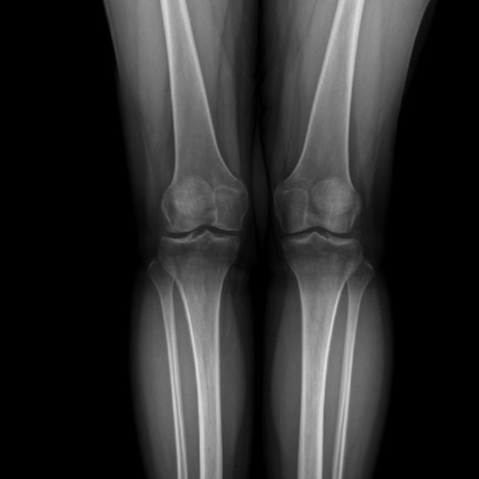 knee x-ray