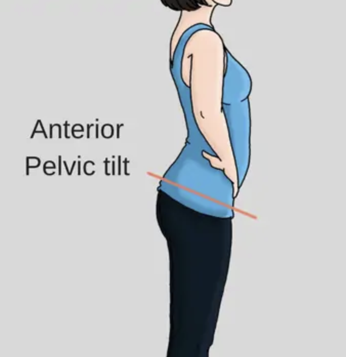 Unraveling the Secrets of Pelvic Imbalance and Posture - Gangnam Seran ...