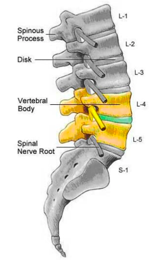 degenerative disc disease