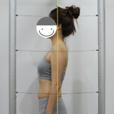 management of Round Shoulder Syndrome - after