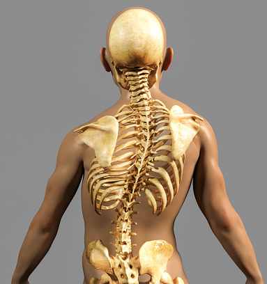 Scoliosis