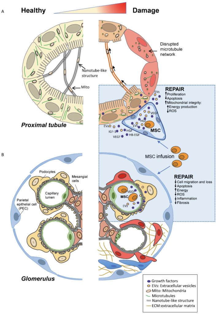 Mechanisms of Stem Cell Therapy for Kidney Disease Patients