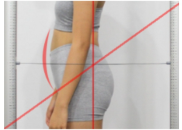 Anterior Pelvic Tilt