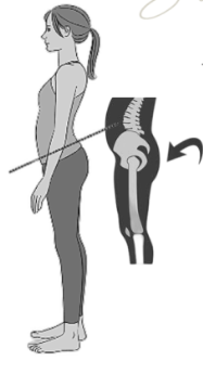 Anterior Pelvic Tilt (APT)