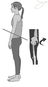 Posterior Pelvic Tilt (PPT)